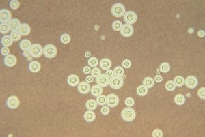 Cryptococcus neoformans Image/CDC