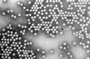 Poliovirus  Image/CDC