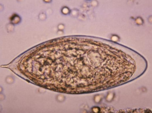Schistosoma haemotobium egg Image/CDC