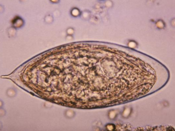 schistosomiasis quest diagnostics
