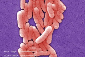 Salmonella Image/CDC