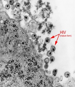 Image/HIV-CDC