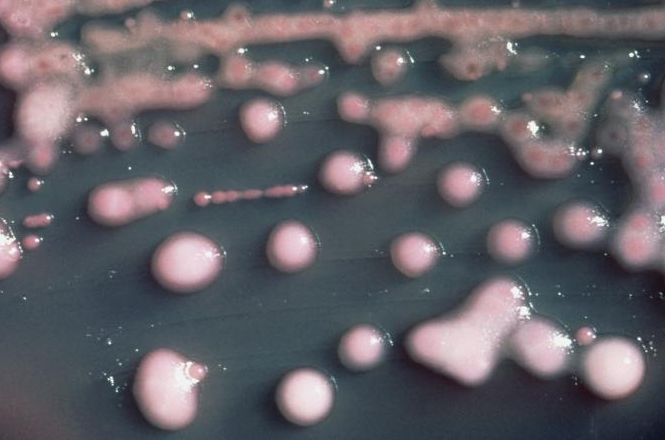 Klebsiella pneumoniae/CDC
