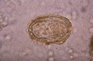 Schistosoma japonicum/CDC