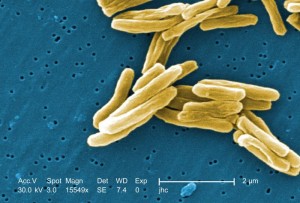 Mycobacterium tuberculosis /Janice Haney Carr