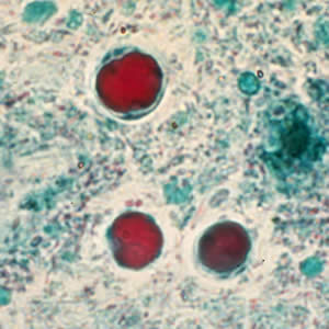 Blastocystis hominis cysts/CDC