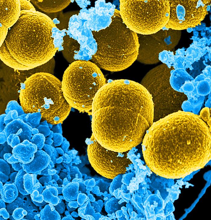 Staphylococcus aureus /CDC