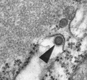 Lyssavirus Image/CDC