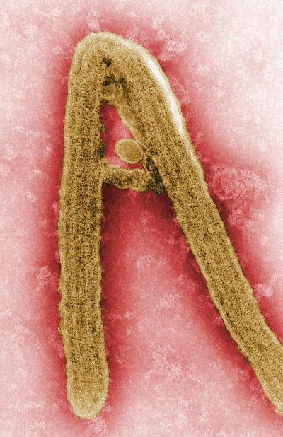 CDC gives suggestions for clinicians and public well being departments about Marburg Virus Illness
