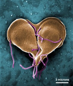 giardia duodenalis cdc hpv any cure