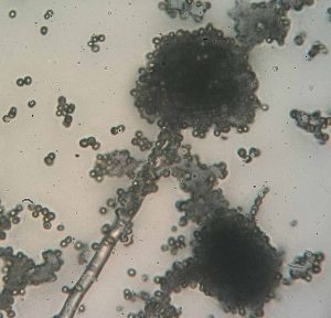 Rhizopus fungus Public domain image/Agong1