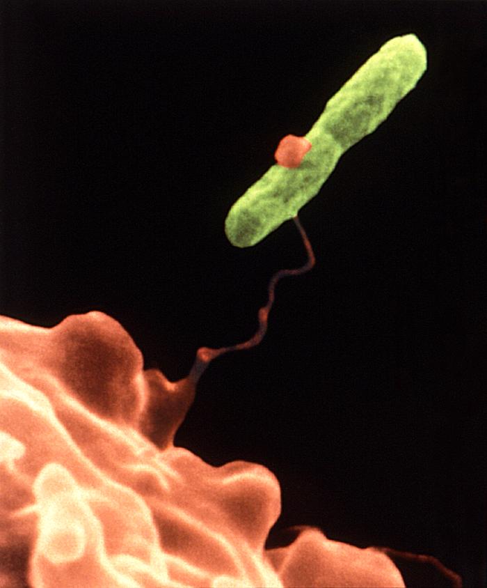 Legionella/CDC