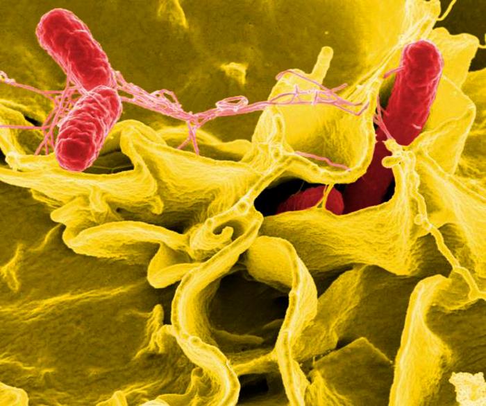 Salmonella bacteria (red)/National Institute of Allergy and Infectious Diseases (NIAID)