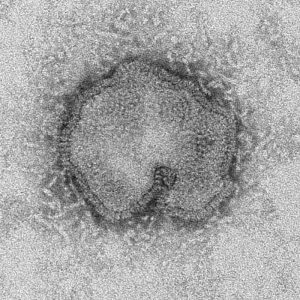 Influenza A (H7N9) virus/CDC