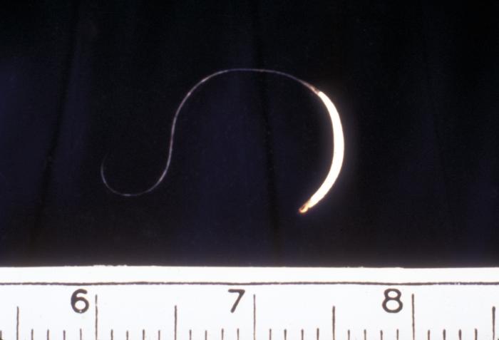 An adult Trichuris female human whipworm/CDC