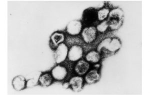 Rubella virus/CDC