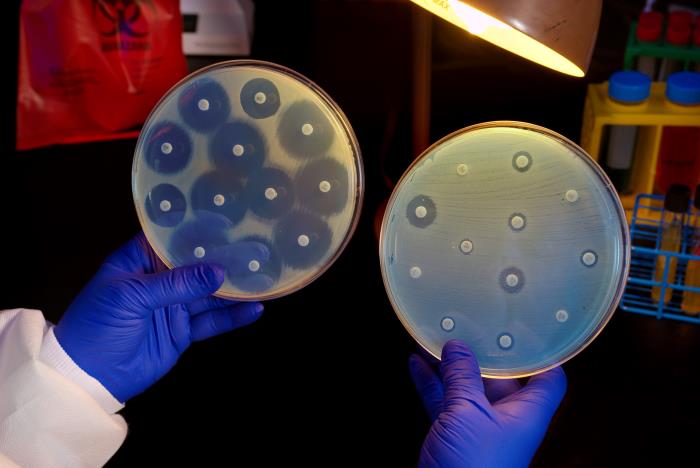 This 2014 image depicts Centers for Disease Control (CDC) microbiologist Kitty Anderson holding up two Petri dish culture plates growing bacteria in the presence of discs containing various antibiotics. The isolate, i.e., bacterial specie, on the left plate is susceptible to the antibiotics on the discs, and is therefore, unable to grow adjacent to the discs. The plate on the right was inoculated with a Carbapenem-Resistant Enterobacteriaceae (CRE) bacterium that proved to be resistant to all of the antibiotics tested, and is therefore, able to grow near the discs/CDC