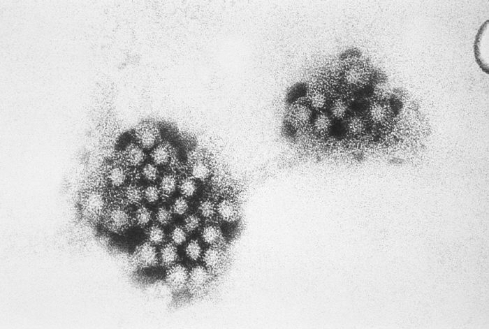 Norovirus/CDC