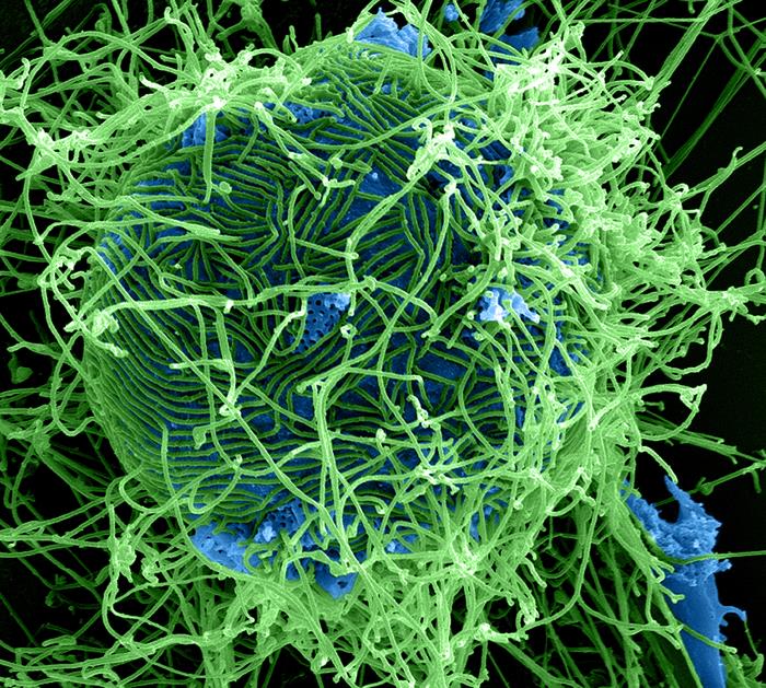 Ebola virus/CDC