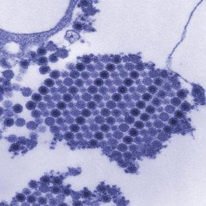 Chikungunya virus/CDC