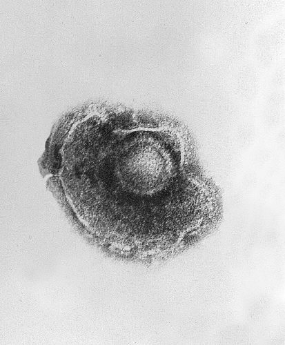 Varicella (Chickenpox) Virus/CDC