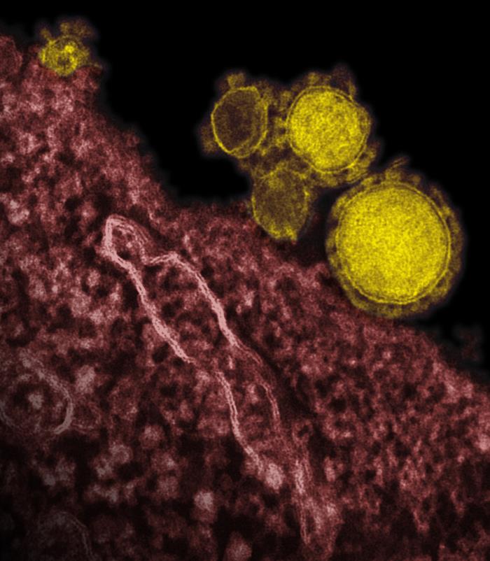  Middle East Respiratory Syndrome Coronavirus (MERS-CoV) /CDC