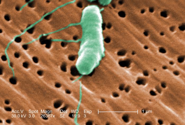 Vibrio vulnificus/CDC