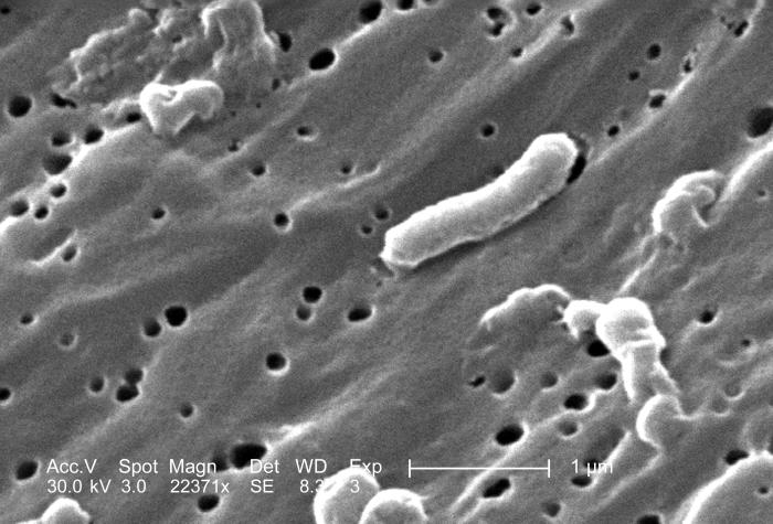 Vibrio cholerae/CDC