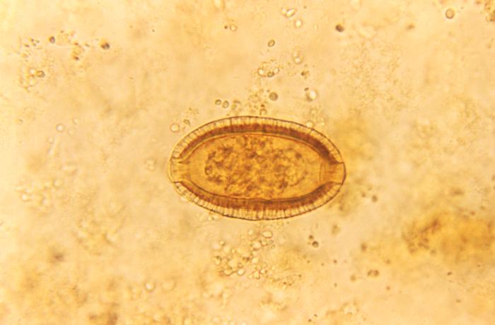 Capillaria philippinensis/CDC
