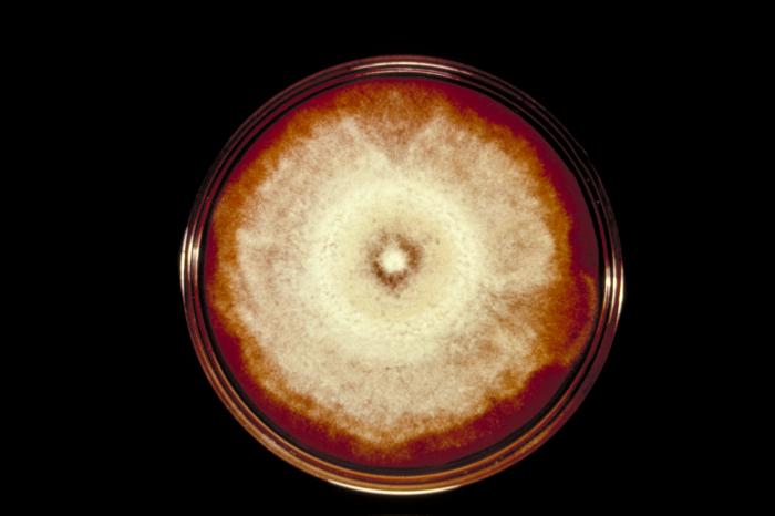Plate culture of Blastomyces dermatitidis/CDC
