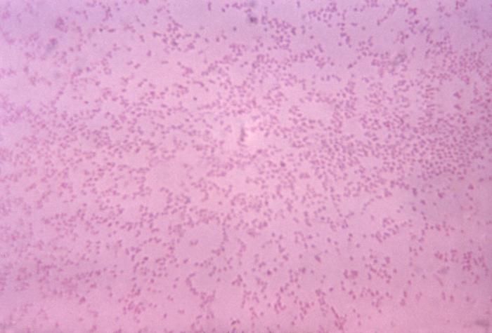 Pasteurella multocida gram stain/CDC