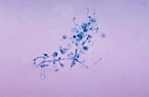 Blastomyces dermatitidis/CDC