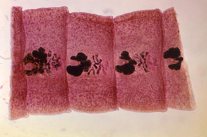 Gravid proglottids of Diphyllobothrium latum/CDC