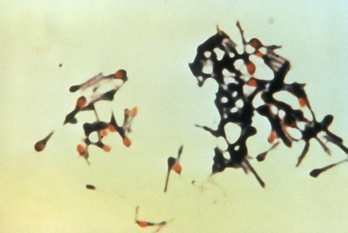 Clostridium tetani /CDC
