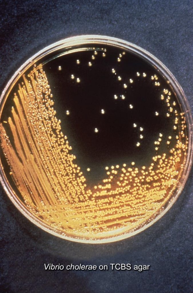 Vibrio cholerae on TCBS/CDC