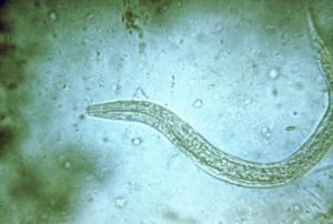 Hookworm/CDC