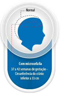 Image/Brazil Health Ministry