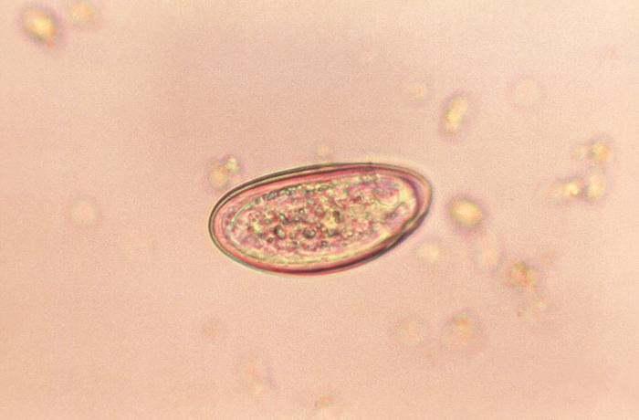 Pinworm egg/CDC