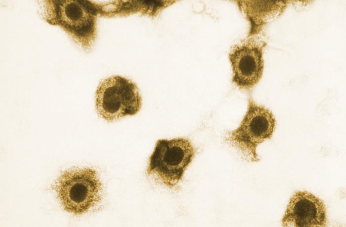 Cytomegalovirus (CMV) Image/CDC
