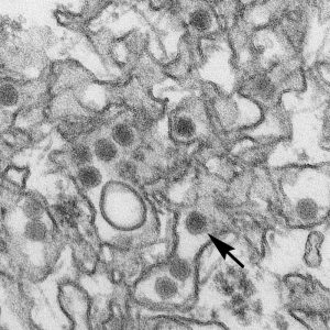 This is a transmission electron micrograph (TEM) of Zika virus/Cynthia Goldsmith