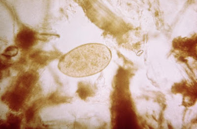 Fasciola hepatica egg Photo/CDC