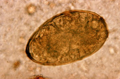 Paragonimus westermani egg/CDC