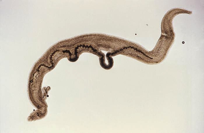 Anticorpi anti Schistosoma mansoni IgG