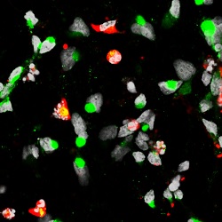 Neural progenitor cells exposed to Zika virus. The virus is shown in green, and cell death is shown in red. Credit: Sarah C. Ogden/Johns Hopkins Medicine