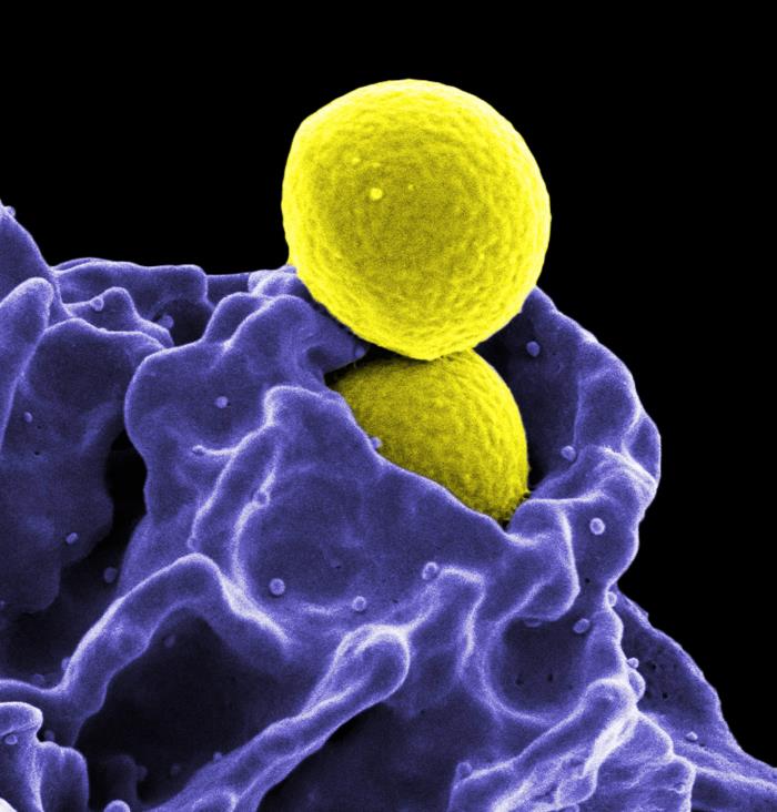 Methicillin-resistant Staphylococcus aureus (MRSA) Image/NIAID