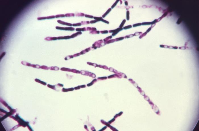 Bacillus anthracis bacteria Image/CDC