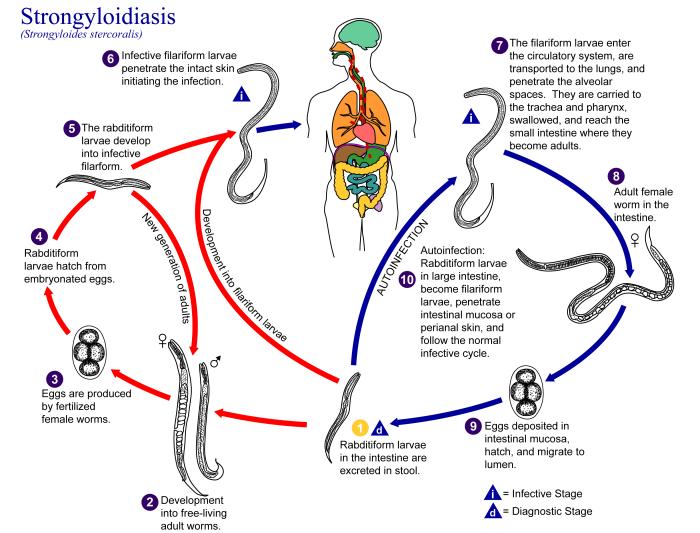 Felnőttkori strongyloidosis tünetek, Strongyloidosis epidemiológia
