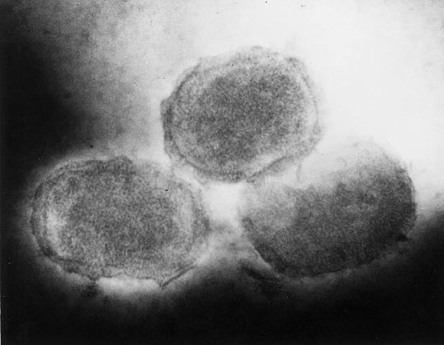 Poxvirus of molluscum contagiosum/CDC