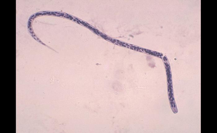 Onchocerca volvulus larvae/CDC