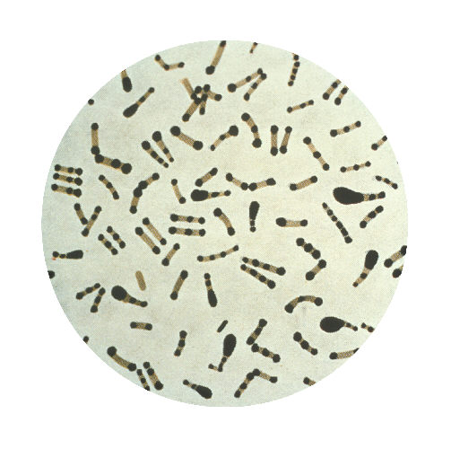 Corynebacterium diphtheriae/CDC